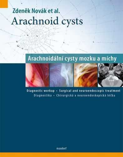 Arachnoid cysts - Arachnoidální cysty mozku a míchy - Novák Zdeněk - 22