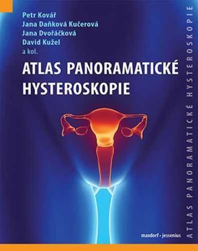 Atlas panoramatické hysteroskopie - Kovář Petr a kolektiv