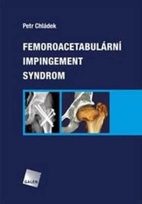 Femoroacetabulární impingement syndrom - Petr Chládek - 20x29 cm