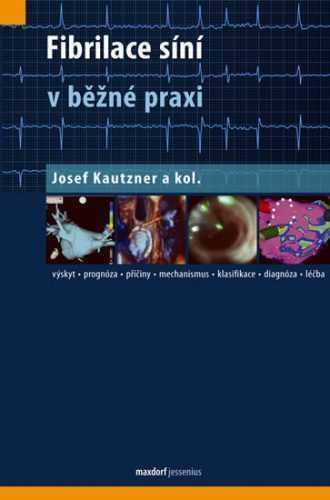Fibrilace síní v běžné praxi - Kautzner Josef a kolektiv - 12