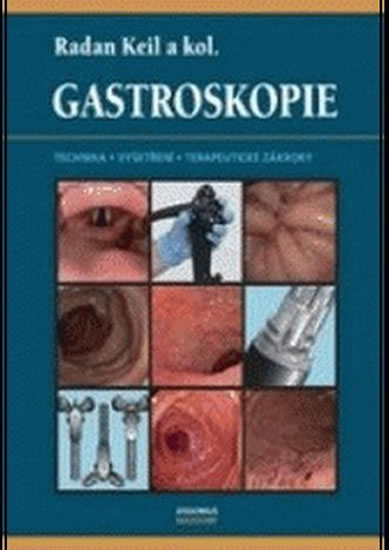 Gastroskopie - Keil Radan a kolektiv