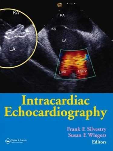 Intracardiac Echocardiography - Silvestry Frank E.