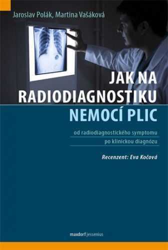 Jak na radiodiagnostiku nemocí plic - Polák Jaroslav