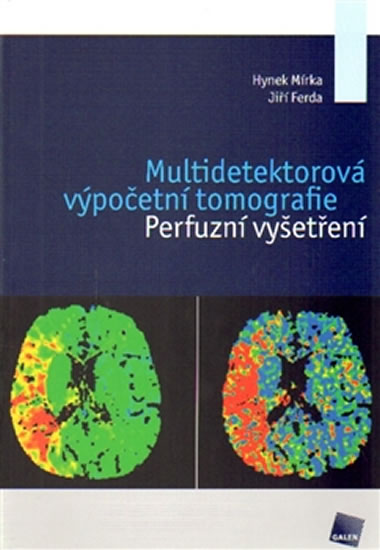 Multidetektorová výpočetní tomografie - Perfuzní vyšetření - Mírka Hynek