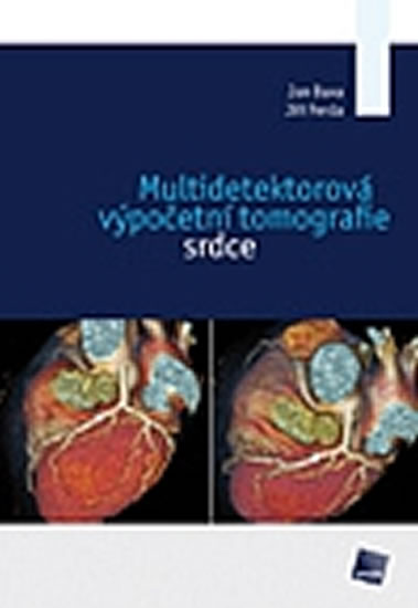 Multidetektorová výpočetní tomografie srdce - Baxa Jan