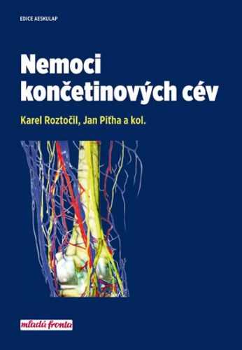 Nemoci končetinových cév - Roztočil Karel