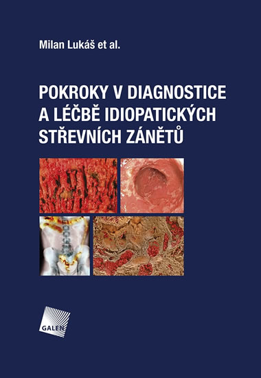 Pokroky v diagnostice a léčbě idiopatických střevních zánětů - Lukáš Milan
