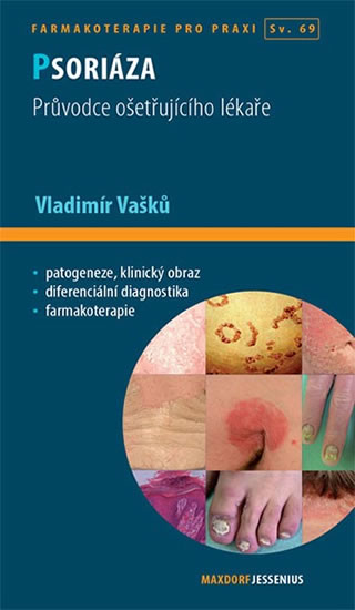 Psoriáza - Průvodce ošetřujícího lékaře - Vašků Vladimír