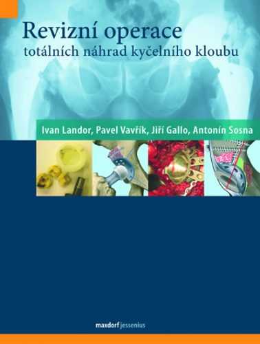 Revizní operace totálních náhrad kyčelního kloubu - kolektiv autorů - 20