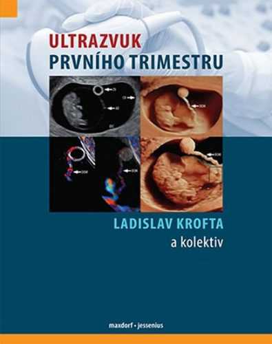Ultrazvuk prvního trimestru - Krofta Ladislav