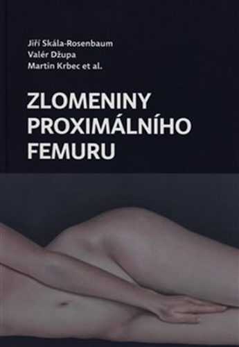 Zlomeniny proximálního femuru - Skála Rosenbaum Jiří