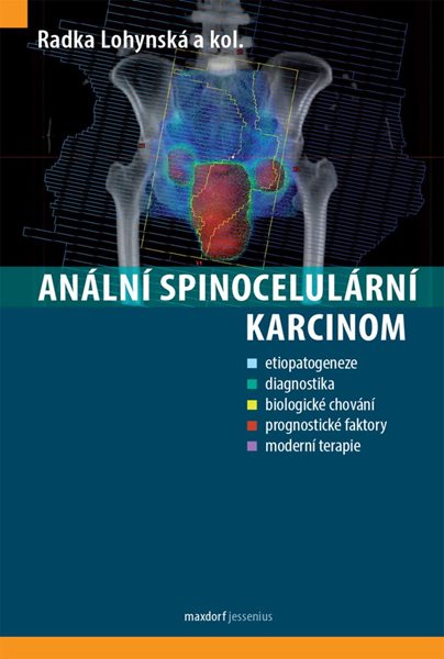 Anální spinocelulární karcinom - Lohynská Radka