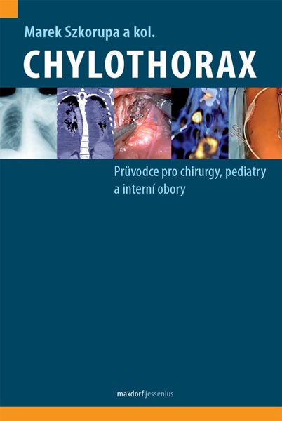 Chylothorax - Průvodce pro chirurgy