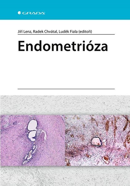 Endometrióza - Lenz Jiří a kolektiv