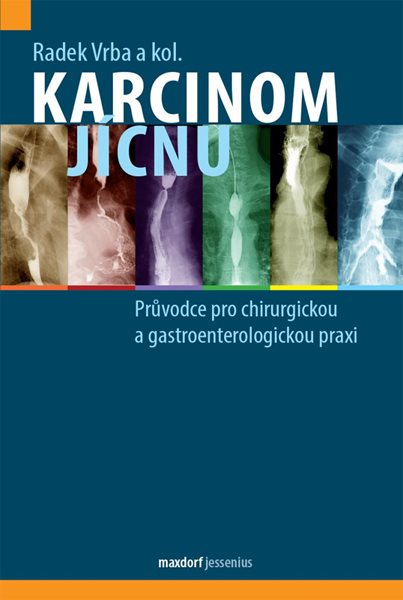 Karcinom jícnu - Průvodce pro chirurgickou a gastroenterologickou praxi - Vrba Radek