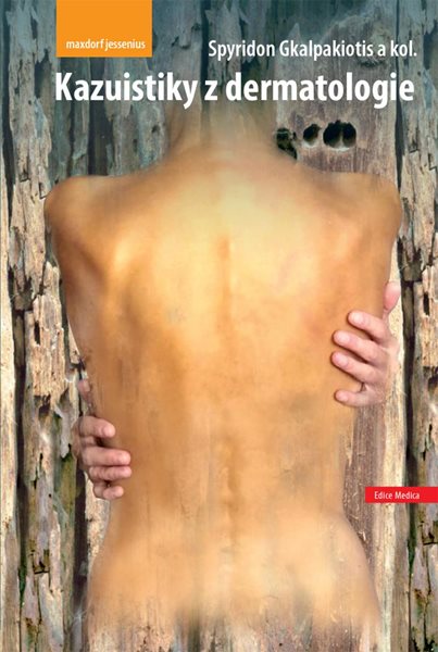 Kazuistiky z dermatologie - Gkalpakiotis Spyridon