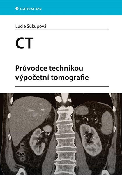 CT - Průvodce technikou výpočetní tomografie - Súkupová Lucie