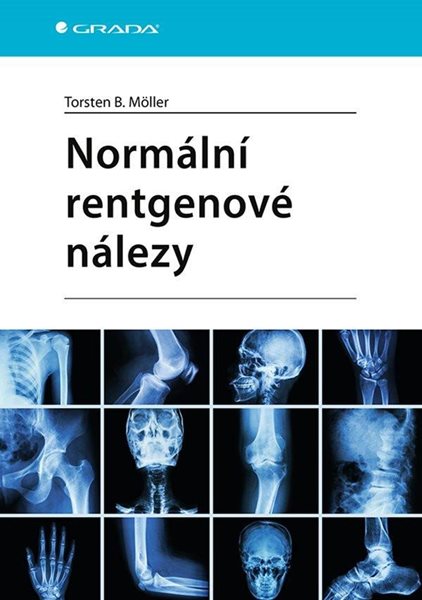 Normální rentgenové nálezy - Möller Torsten B.